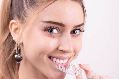 Invisalign