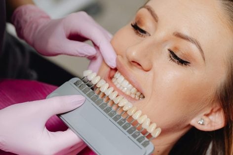 Blanqueamiento Dental: Todo lo que Necesitas Saber Antes de Hacerlo