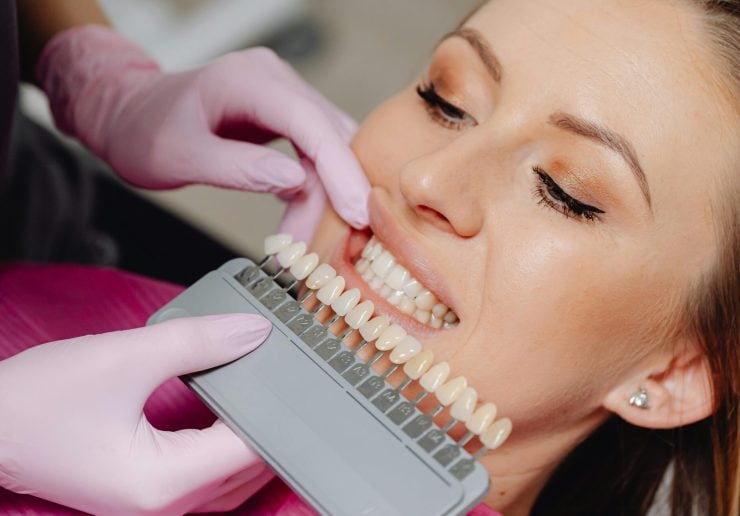 Blanqueamiento dental