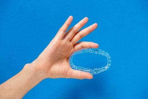 ¿Cómo funciona Invisalign? Paso a paso del tratamiento