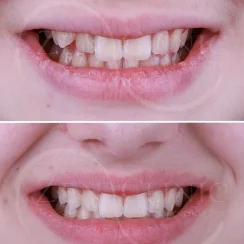 Zenclinic Dental on Instagram, post 1