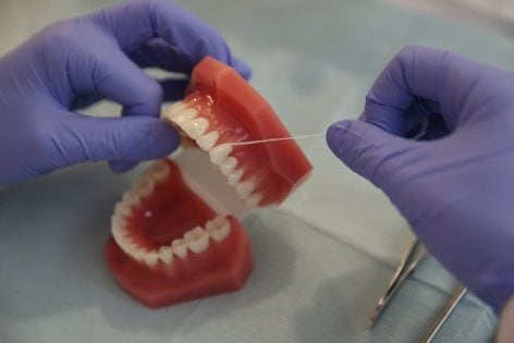 Cuidados que debo tener si tengo carillas dentales