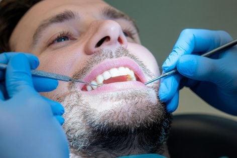 Implantes Dentales: La Solución Moderna para Recuperar tu Sonrisa